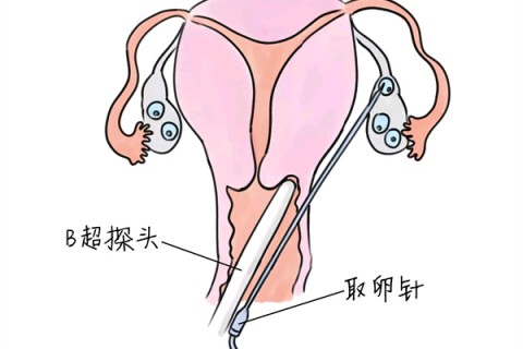 http://nizifen8.com/post/199.html|供卵助孕